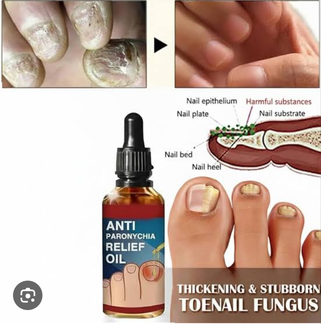 Jaysuing Anti Paronychia Relief Oil 10ml